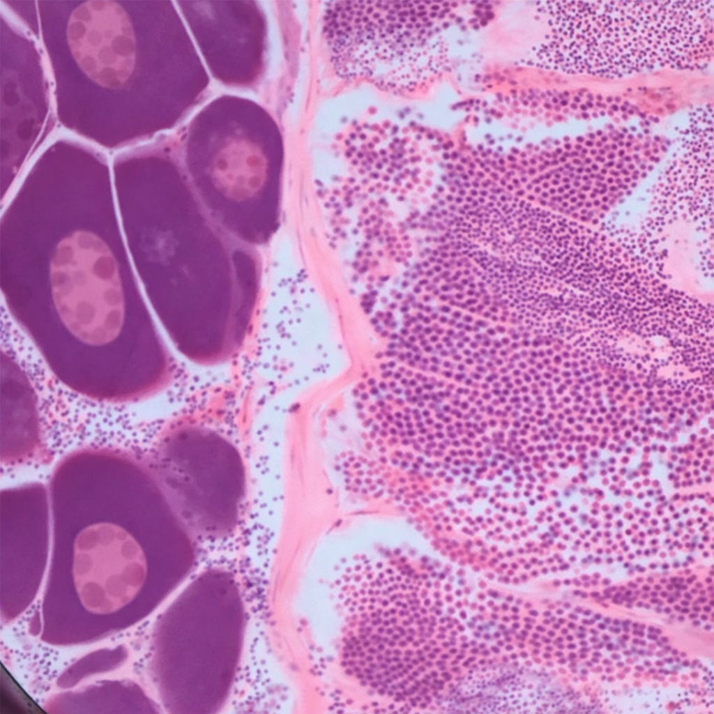 Peces feminizados: 'medioambiente y sexo submarino'